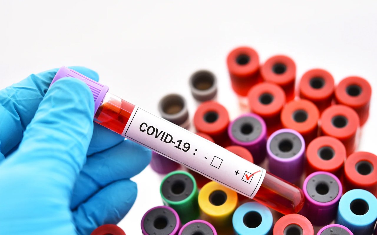 covid 19 corona virus abd hcms cover Вакцины от Covid-19 могут нести даже бОльшую угрозу для вакцинированных, чем сама болезнь. Фактов этого всё больше и больше